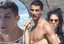 Ronaldo përfundon me sy të nxirë! (Foto)