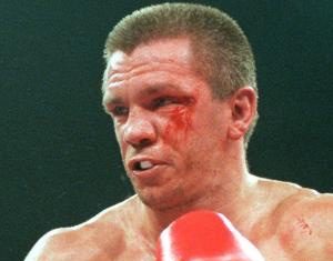 Ish-kampioni i botës humb jetën në aksidentin