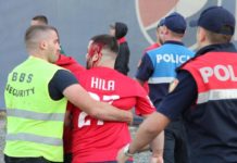 Gjakoset derbi, tifozët e Tiranës dhe Partizanit përleshen para ndeshjes