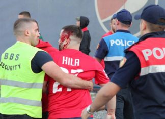 Gjakoset derbi, tifozët e Tiranës dhe Partizanit përleshen para ndeshjes