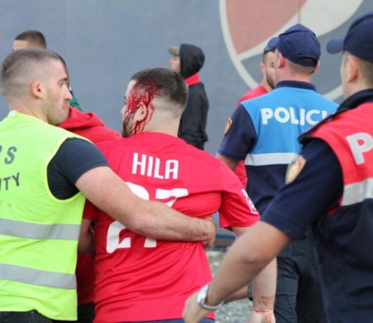 Gjakoset derbi, tifozët e Tiranës dhe Partizanit përleshen para ndeshjes