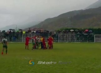 Grusht në nofull futbollistit, flasin mjekët: S’ka rrezik, lojtari u operua