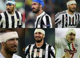 Ka thyer 5 herë hundën/ Angli, kujdes nga ‘Gorilla’ me diplomë