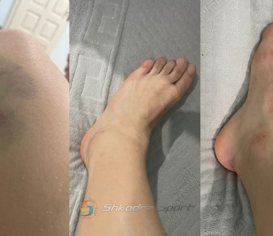 Kështu doni të ndalni Vllazninë e femrave?!